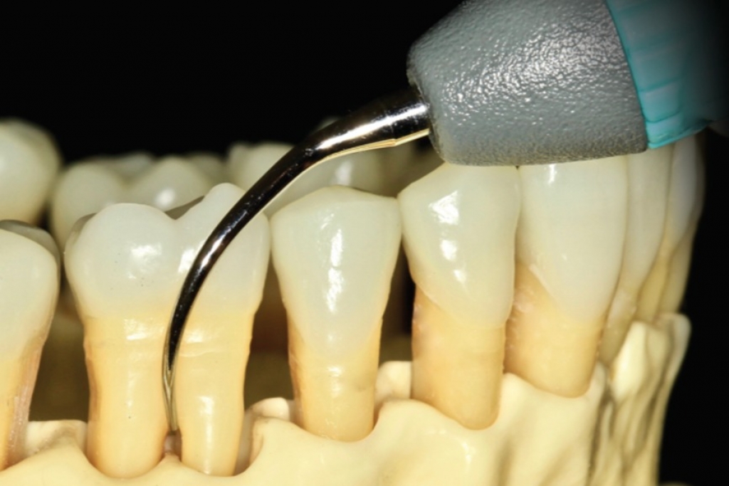 牙齦萎縮怎麼辦?