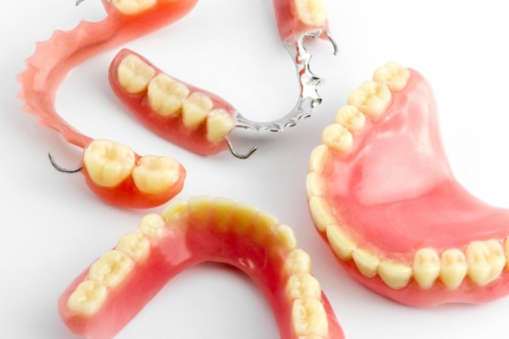 什麼是活動式假牙? 什麼又是固定式假牙?